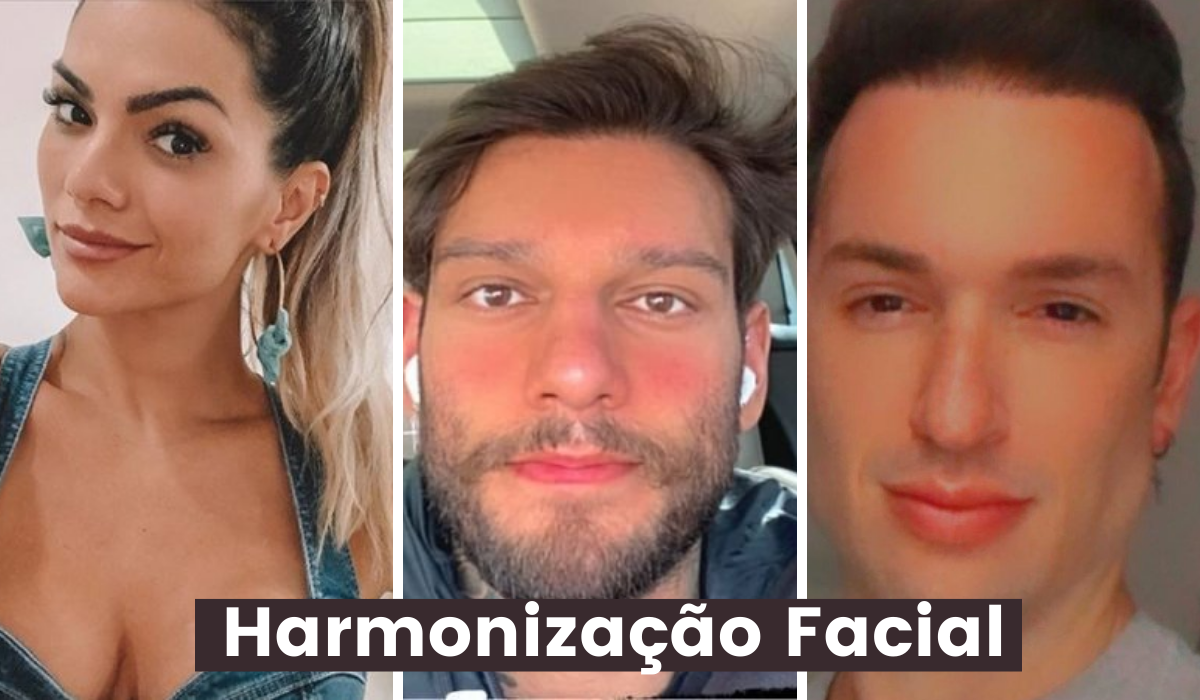harmonização facial