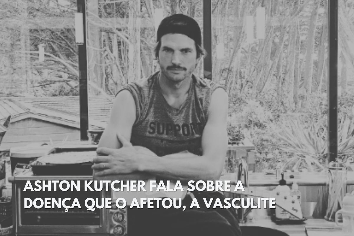 Ashton Kutcher - vasculite Ashton Kutcher - vasculite