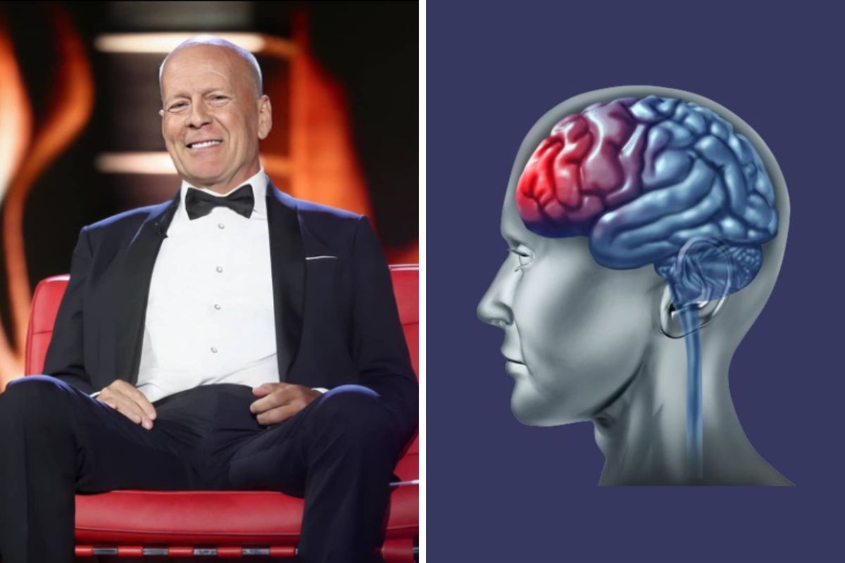 Demência Frontotemporal - Bruce Willis